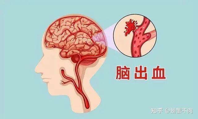 高血压的危害你注意了吗？